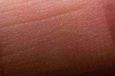 Skin_22_533_355.jpg Skin_22_533_355.jpg