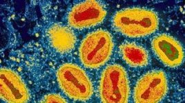 smallpox.jpg smallpox.jpg