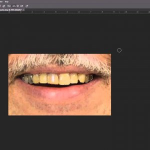 18. Retouch - Λεύκανση δοντιών στο Photoshop CS6